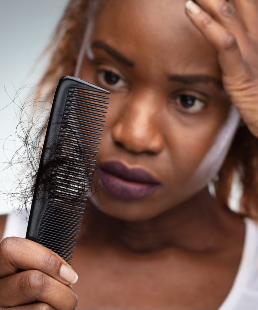 Woman holding a comb full of hair