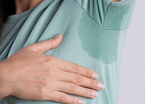 Woman with hyperhidrosis looking at her armpit sweat