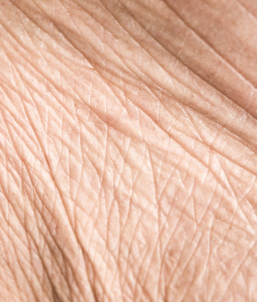 Close-up on aging skin